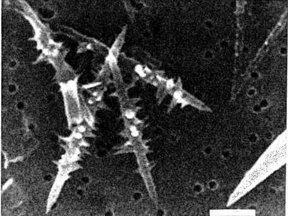 An electron microscope image shows the tiny, spiny, star-shaped sponge spicules.